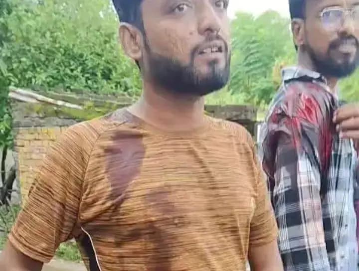  लखनऊ के ठाकुरगंज क्षेत्र में हैदरगंज पुलिया के पास 2 लोगों पर जानलेवा हमला