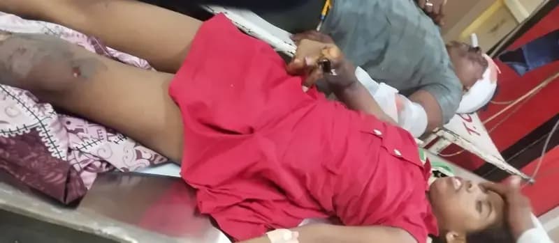 छत पर कपड़ा सुखाने गई थी नौ साल की मासूम,11000 लाइन की चपेट में आकर झुलसी

