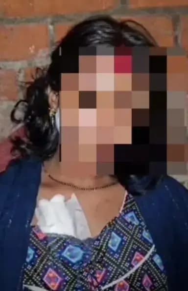  ठाकुरगंज क्षेत्र के भूहर चौकी क्षेत्र फ़रीदीपुर में चोरों के हमले से एक महिला गंभीर रूप से घायल 

 