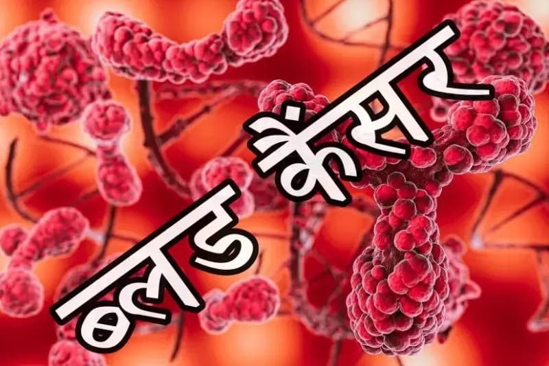  ब्लड कैंसर के लक्षण और उपचार का सही ढंग,वरना जान पर ​आ सकती बात