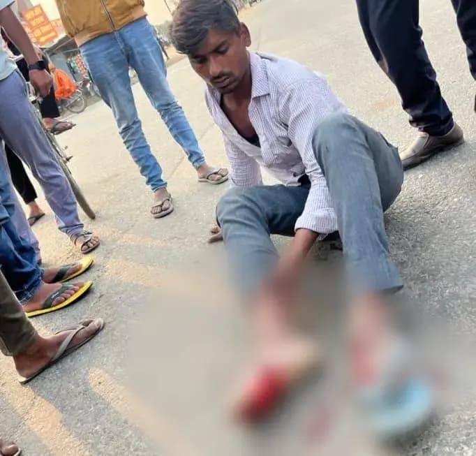 तेज रफ्तार कार ने मोटर साइकिल सवार को मारी टक्कर, युवक का टूटा पैर