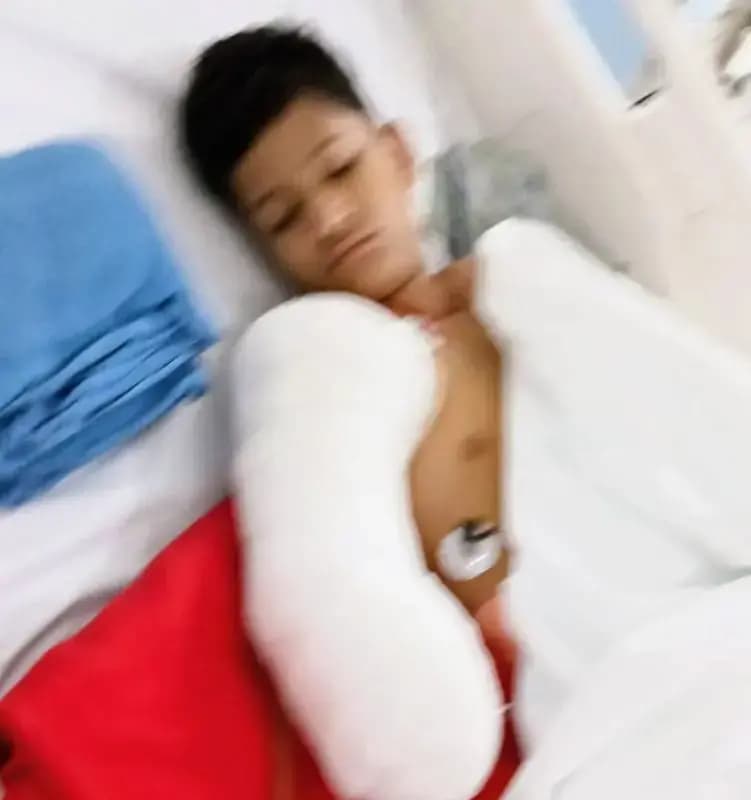 बिजली विभाग की लापरवाही से 11 साल के मासूम को गवांना पड़ा हाथ